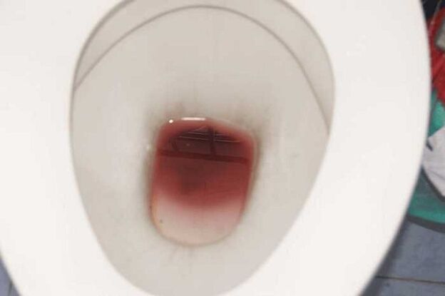 มองเห็นผู้ชายเมื่อตื่นเต้น